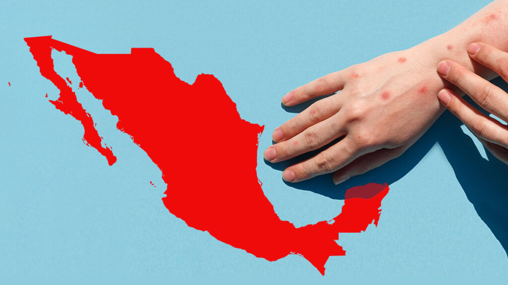 sarampion-en-mexico-153917-1024x576 México en alerta por brote de sarampión: se reportan 86 nuevos casos en un solo día